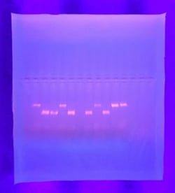 PCR and gel electrophoresis results SA 2016